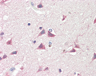 DCDC2 Antibody in Immunohistochemistry (Paraffin) (IHC (P))