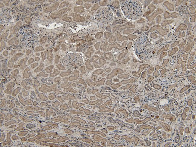 VPS25 Antibody in Immunohistochemistry (Paraffin) (IHC (P))