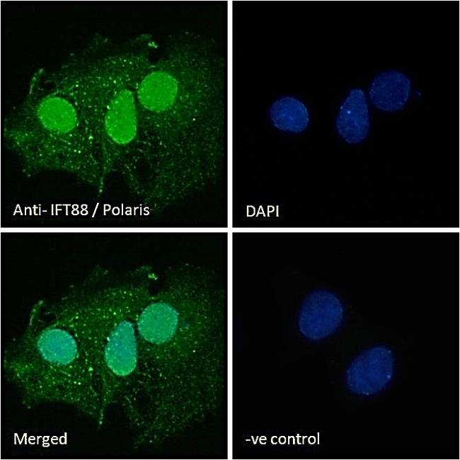 IFT88 Antibody in Immunocytochemistry (ICC/IF)