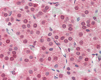 PARP2 Antibody in Immunohistochemistry (Paraffin) (IHC (P))