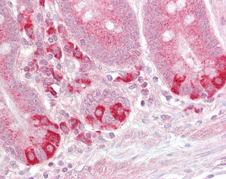 TRAF1 Antibody in Immunohistochemistry (Paraffin) (IHC (P))