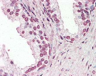 PIAS2 Antibody in Immunohistochemistry (Paraffin) (IHC (P))