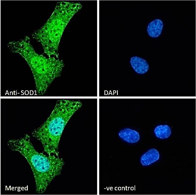 SOD1 Antibody in Immunocytochemistry (ICC/IF)