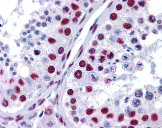 NONO Antibody in Immunohistochemistry (Paraffin) (IHC (P))