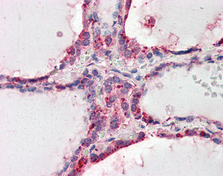 WNT3 Antibody in Immunohistochemistry (Paraffin) (IHC (P))