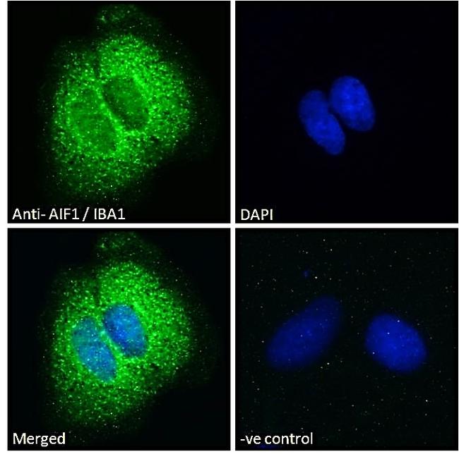 IBA1 Antibody in Immunocytochemistry (ICC/IF)