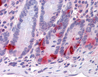 Chromogranin A Precursor Antibody in Immunohistochemistry (Paraffin) (IHC (P))