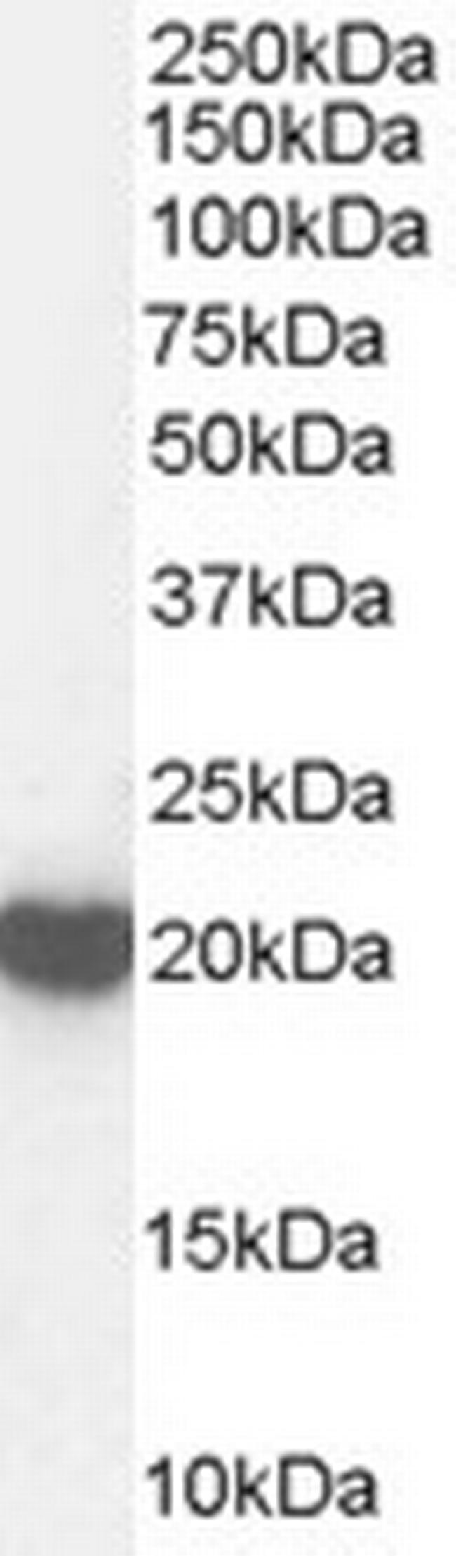 PRDX2 Antibody in Western Blot (WB)