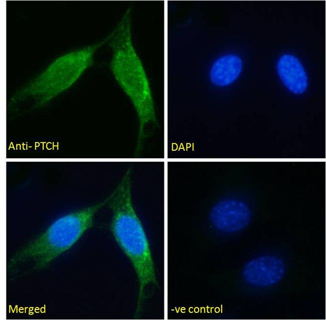 PTCH Antibody in Immunocytochemistry (ICC/IF)