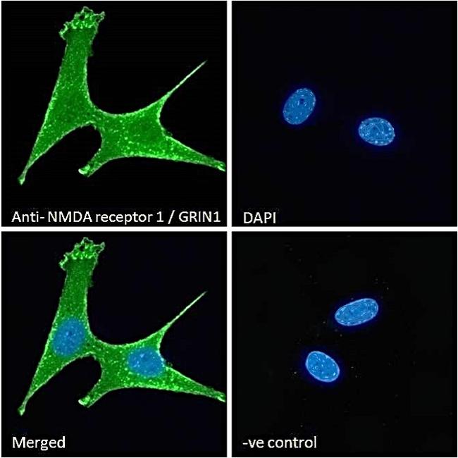 NMDAR1 Antibody in Immunocytochemistry (ICC/IF)