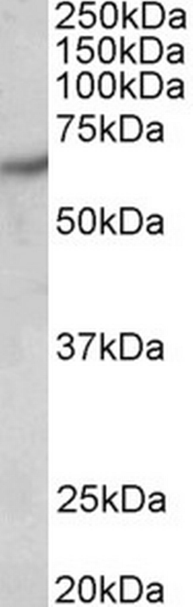 PAK1 Antibody in Western Blot (WB)