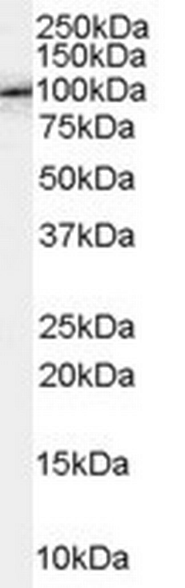 Fe65 Antibody in Western Blot (WB)