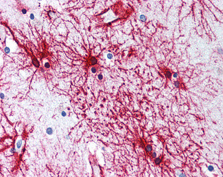 GFAP Antibody in Immunohistochemistry (Paraffin) (IHC (P))