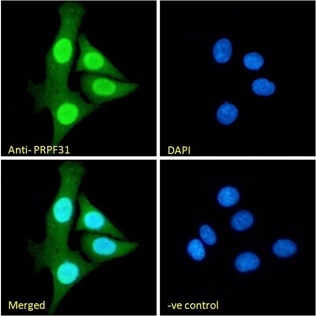 PRPF31 Antibody in Immunocytochemistry (ICC/IF)