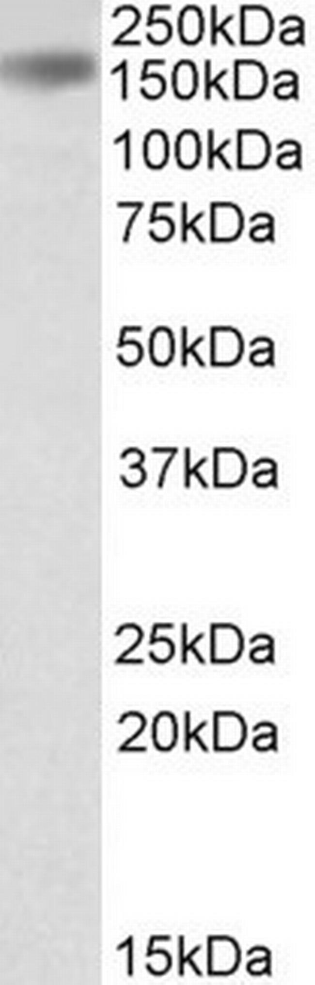 Drosha Antibody in Western Blot (WB)