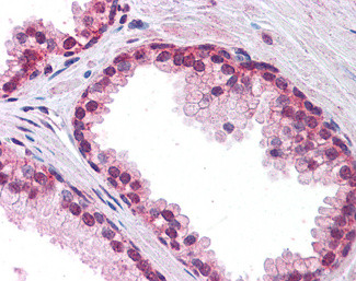 FOXP2 Antibody in Immunohistochemistry (Paraffin) (IHC (P))