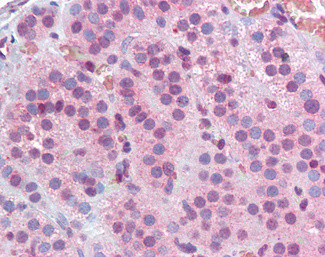 MBD2 Antibody in Immunohistochemistry (Paraffin) (IHC (P))