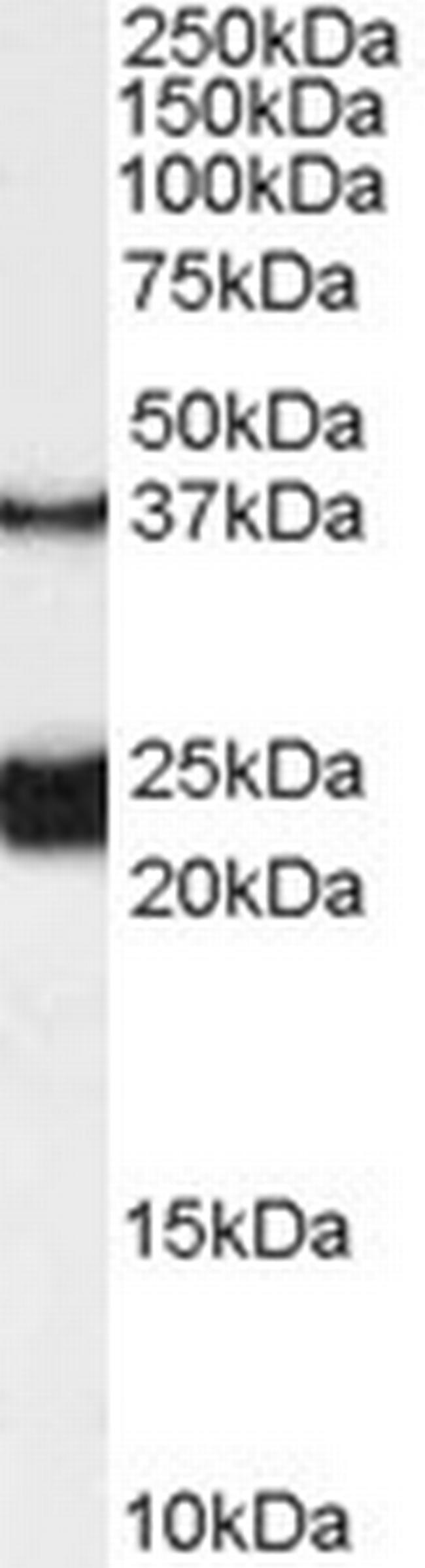 GALR1 Antibody in Western Blot (WB)