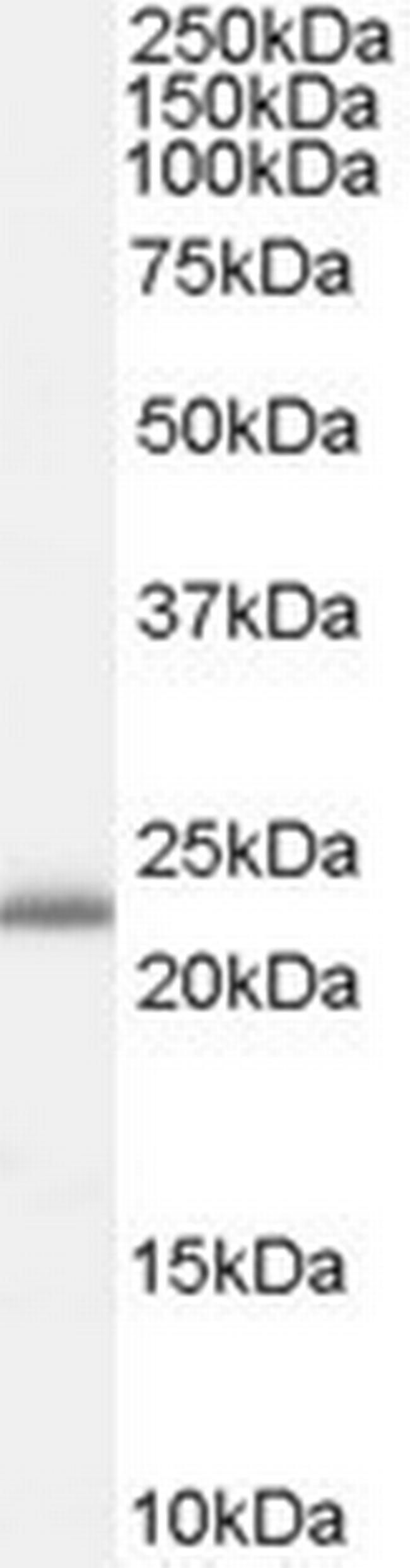 RBP4 Antibody in Western Blot (WB)