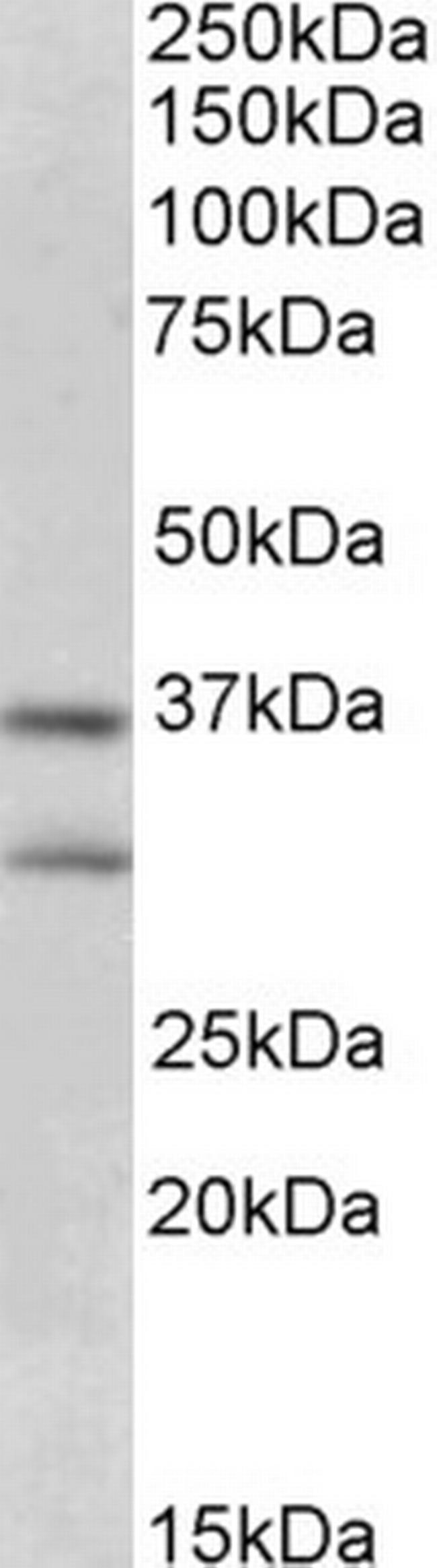 FGF23 Antibody in Western Blot (WB)