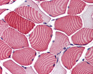 AS160 Antibody in Immunohistochemistry (Paraffin) (IHC (P))