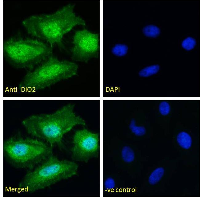 DIO2 Antibody in Immunocytochemistry (ICC/IF)