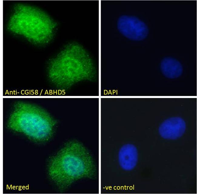 CGI58 Antibody in Immunocytochemistry (ICC/IF)