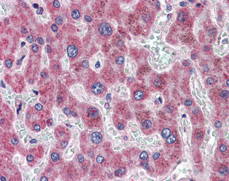 DGAT2 Antibody in Immunohistochemistry (Paraffin) (IHC (P))