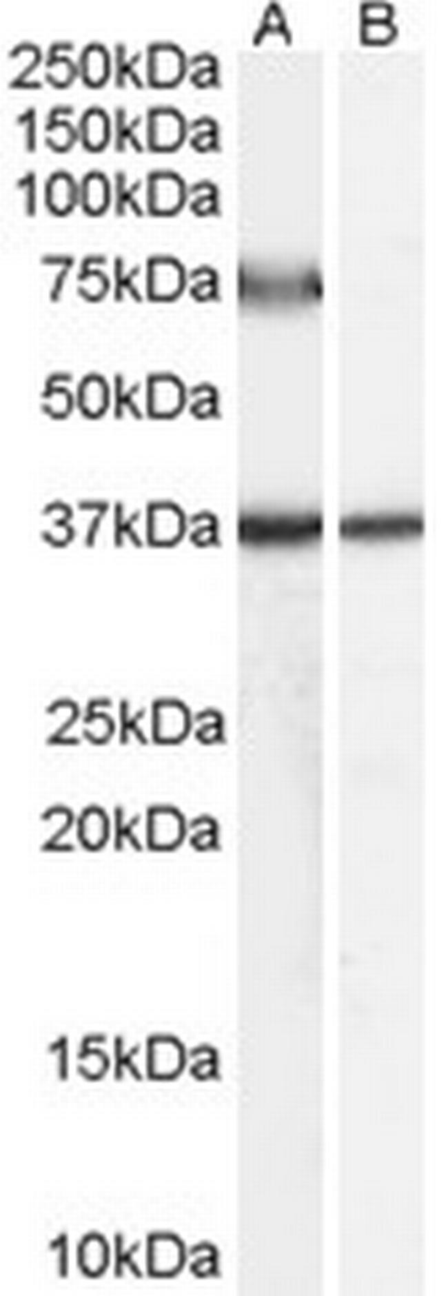 ACOX2 Antibody in Western Blot (WB)