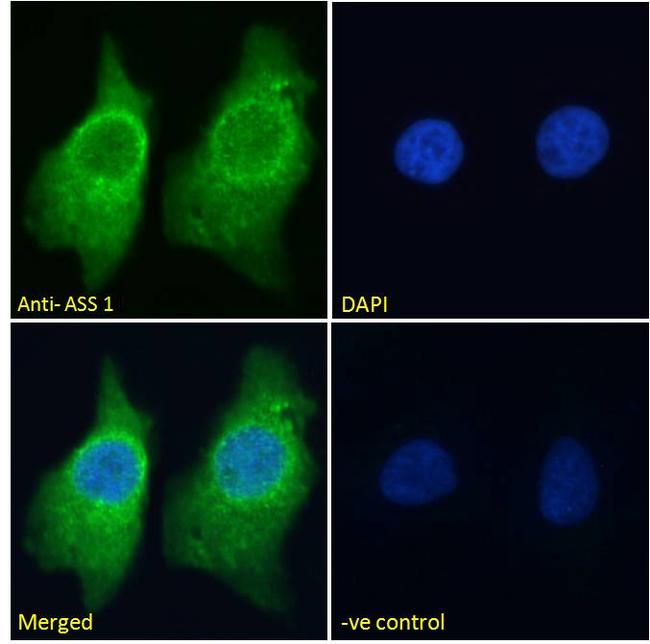 ASS1 Antibody in Immunocytochemistry (ICC/IF)