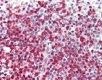 DKC1 Antibody in Immunohistochemistry (Paraffin) (IHC (P))