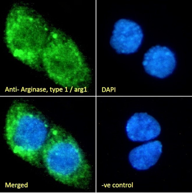 Arginase 1 Antibody in Immunocytochemistry (ICC/IF)