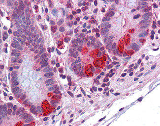 PDIA2 Antibody in Immunohistochemistry (Paraffin) (IHC (P))