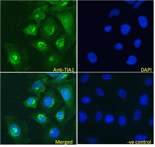 TIA-1 Antibody in Immunocytochemistry (ICC/IF)