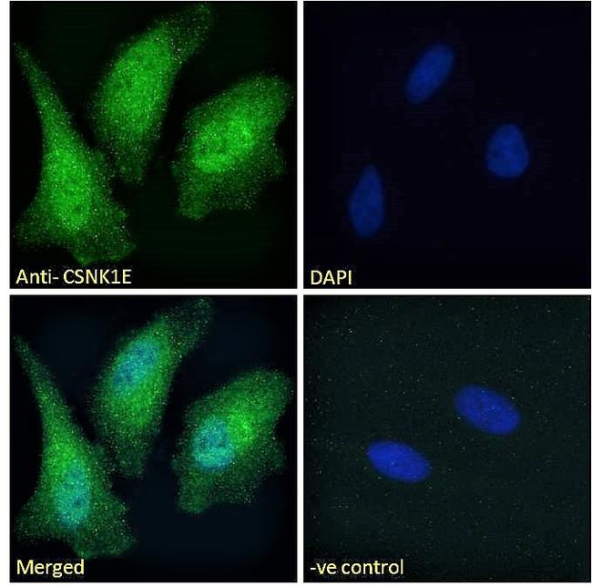 CK1 epsilon Antibody in Immunocytochemistry (ICC/IF)