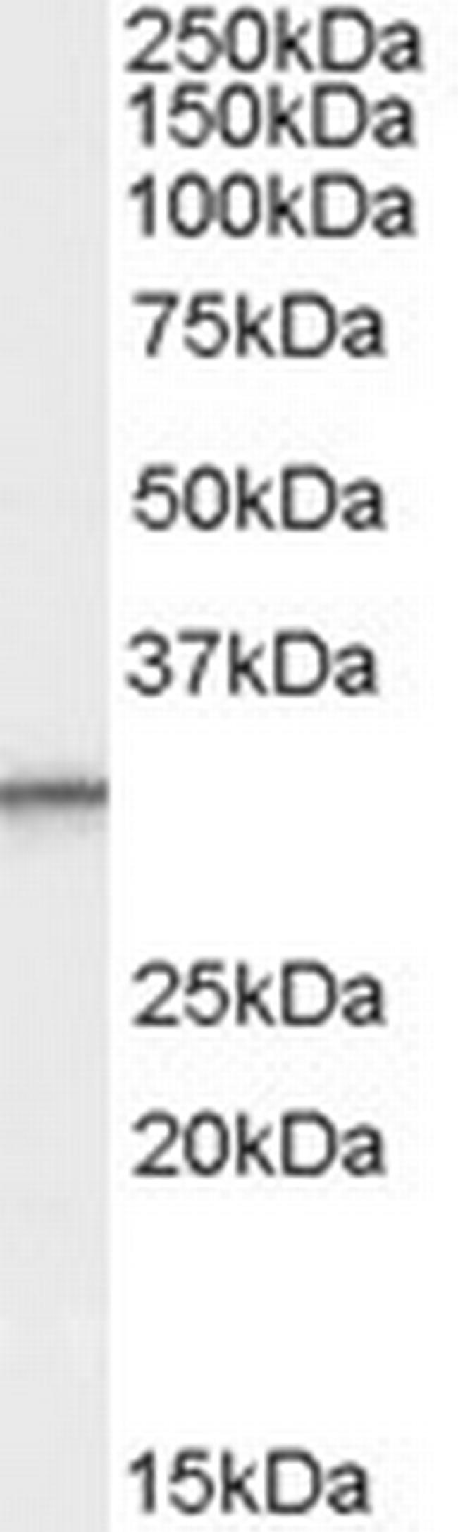 PSME1 Antibody in Western Blot (WB)