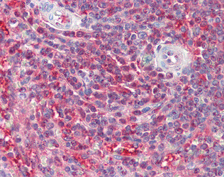 PSME2 Antibody in Immunohistochemistry (Paraffin) (IHC (P))