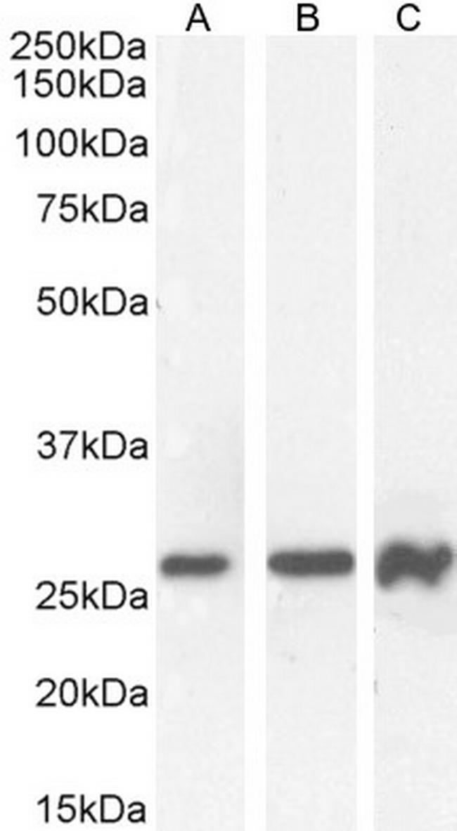 PAX6 Antibody in Western Blot (WB)