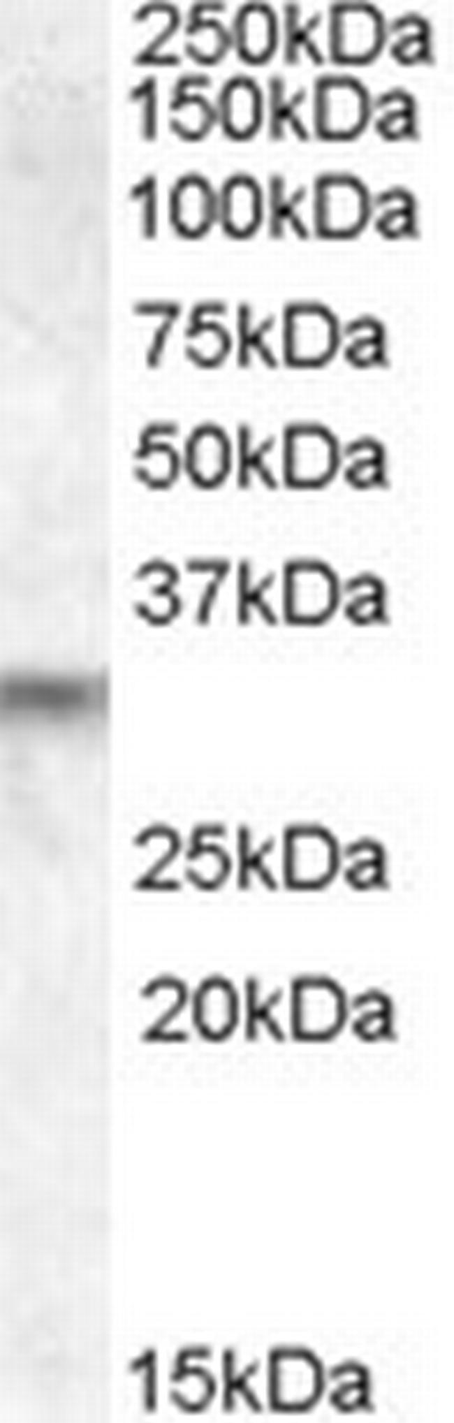 PRUNE2 Antibody in Western Blot (WB)