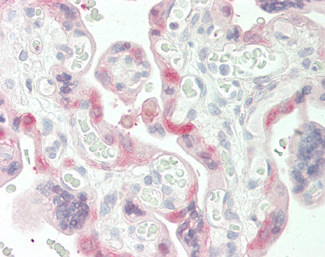 TGM2 Antibody in Immunohistochemistry (Paraffin) (IHC (P))