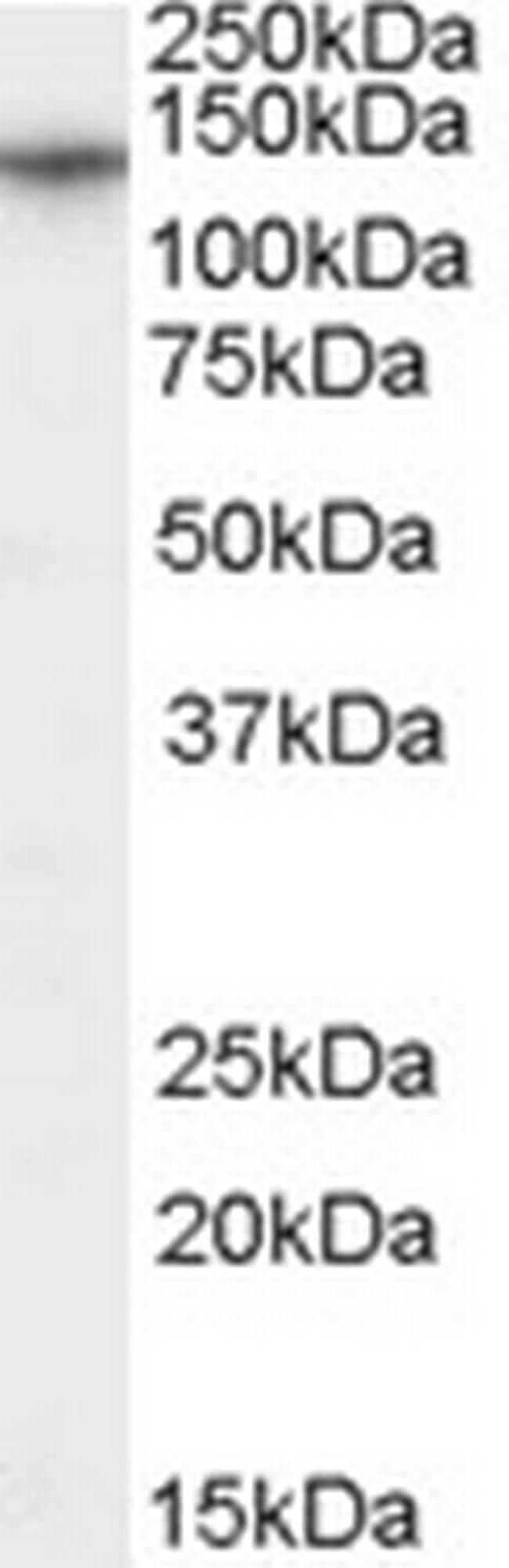 CACNA2D1 Antibody in Western Blot (WB)