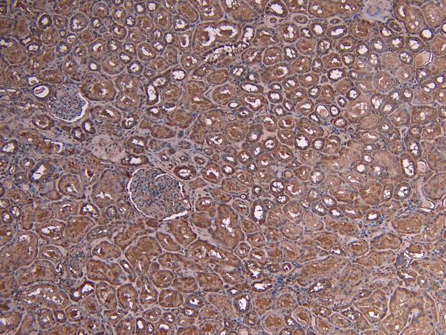 Myb Antibody in Immunohistochemistry (Paraffin) (IHC (P))