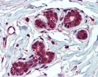 IDE Antibody in Immunohistochemistry (Paraffin) (IHC (P))