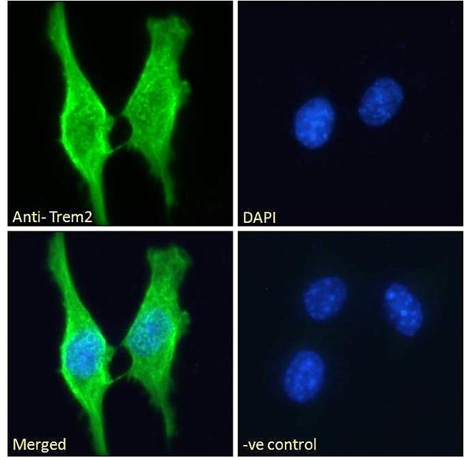 TREM2 Antibody in Immunocytochemistry (ICC/IF)