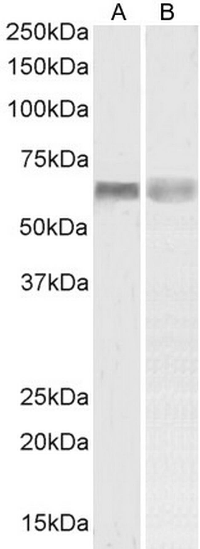 PINK1 Antibody in Western Blot (WB)