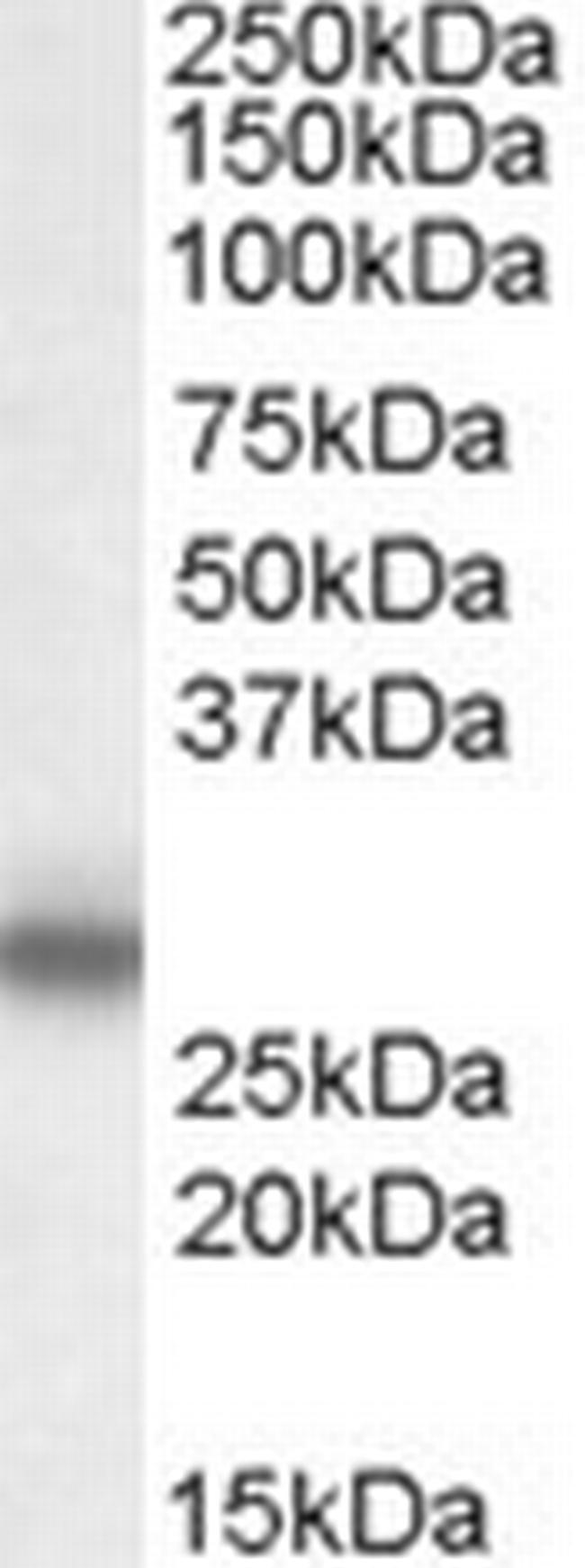 MPZ Antibody in Western Blot (WB)