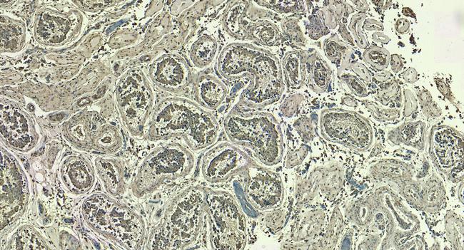 LDHC Antibody in Immunohistochemistry (Paraffin) (IHC (P))