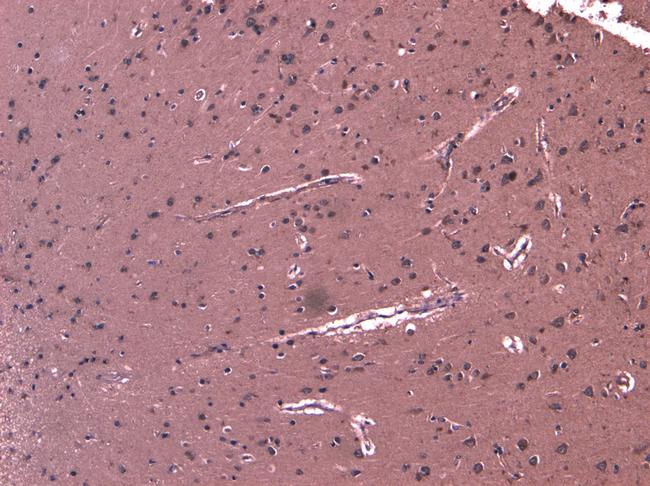 LGP2 Antibody in Immunohistochemistry (Paraffin) (IHC (P))