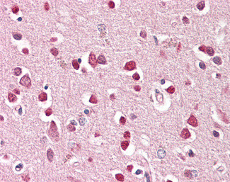 GRIK1 Antibody in Immunohistochemistry (Paraffin) (IHC (P))