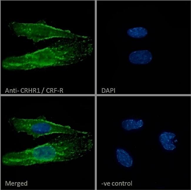 CRHR1 Antibody in Immunocytochemistry (ICC/IF)